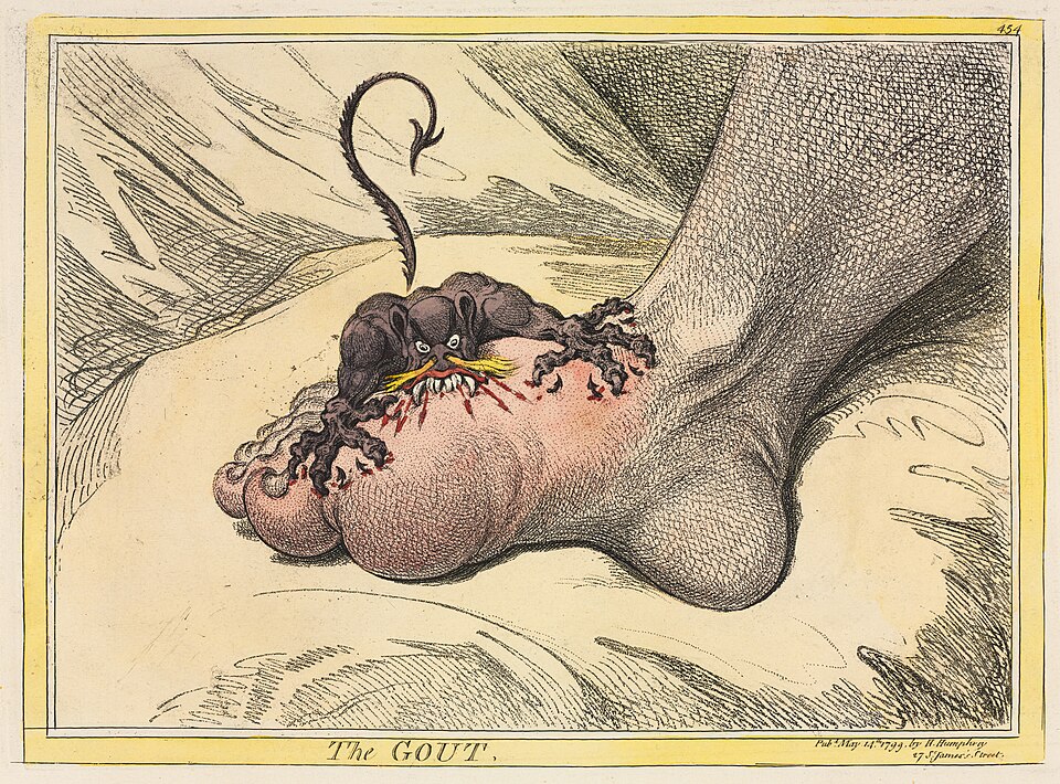 Caricature of a small black demon biting into a swollen, inflamed foot resting on a cushion.